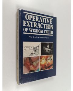 Kirjailijan Peter Tetsch käytetty kirja Operative extraction of wisdom teeth