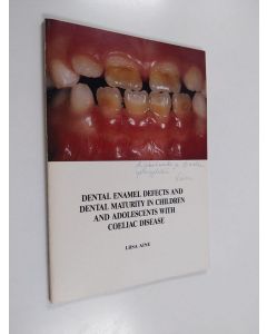 Kirjailijan Liisa Aine käytetty kirja Dental enamel defects and dental maturity in children and adolescents with coeliac disease