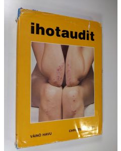 Kirjailijan Väinö K. Havu käytetty kirja Ihotaudit