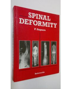 Kirjailijan P. Stagnara käytetty kirja Spinal Deformity