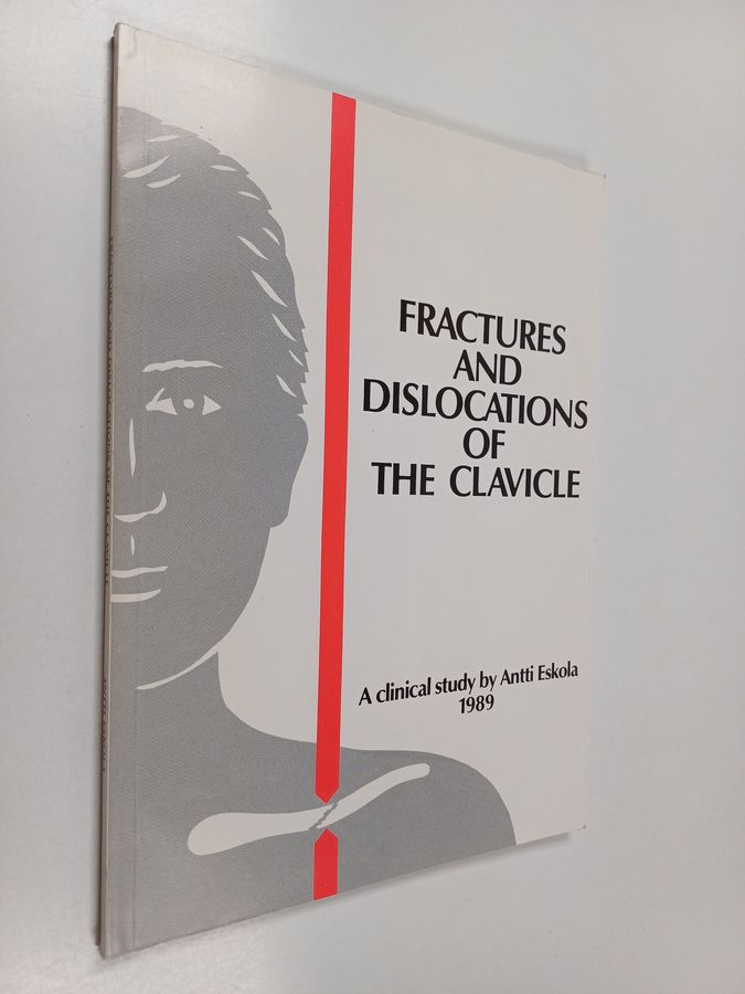 Fractures and dislocations of the clavicle