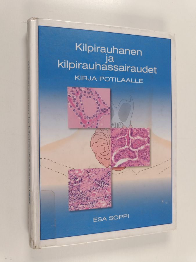 Kilpirauhanen ja kilpirauhassairaudet