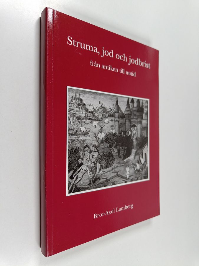 Struma, jod och jodbrist från antiken till nutid