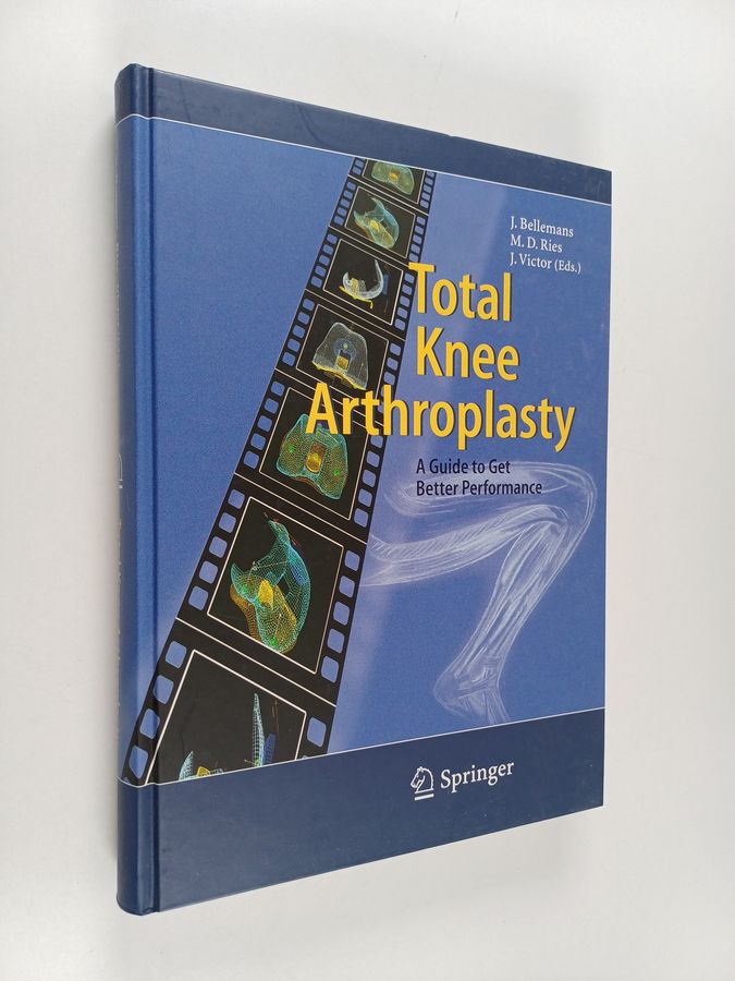 Total Knee Arthroplasty - A Guide To Get Better Performance