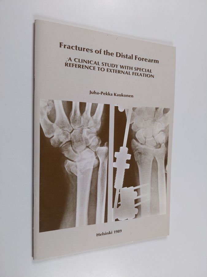 Fractures of the distal forearm