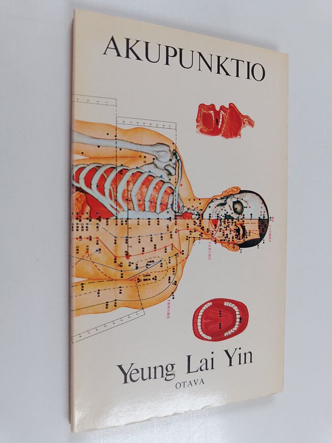 Akupunktio